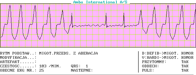 EKG wykresy z łyżek, Pierwsza Pomoc - c25-0.png