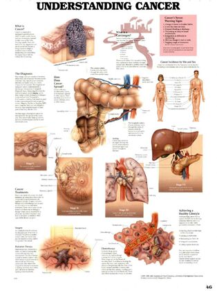 Plansze Anatomiczne - Plansza anatomiczna rak.jpg